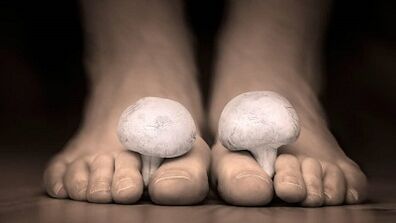 how to recognize the presence of fungus on the legs